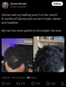 Here's How People Are Using Beyoncé’s Cécred Restoring Hair & Edge
